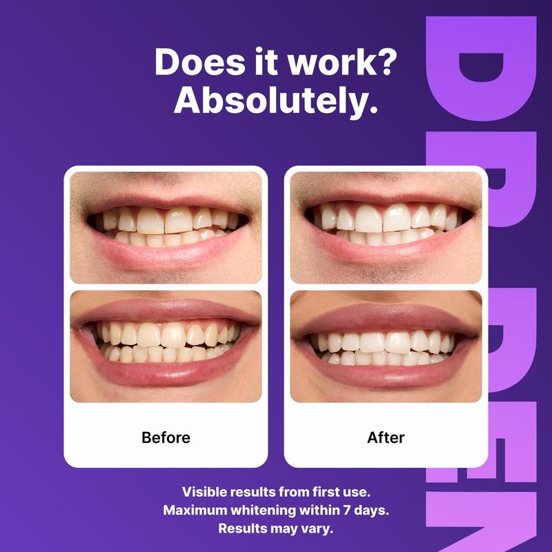 Serien Co - Teeth Whitening Strips
