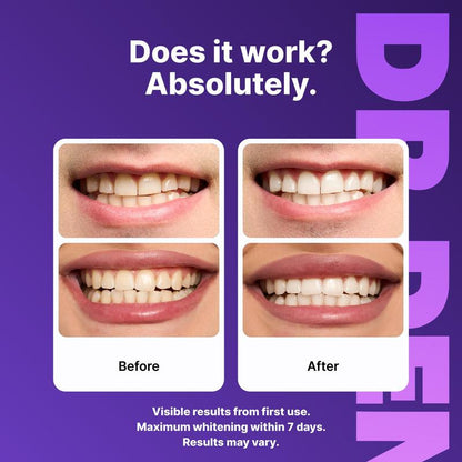 Serien Co - Teeth Whitening Strips